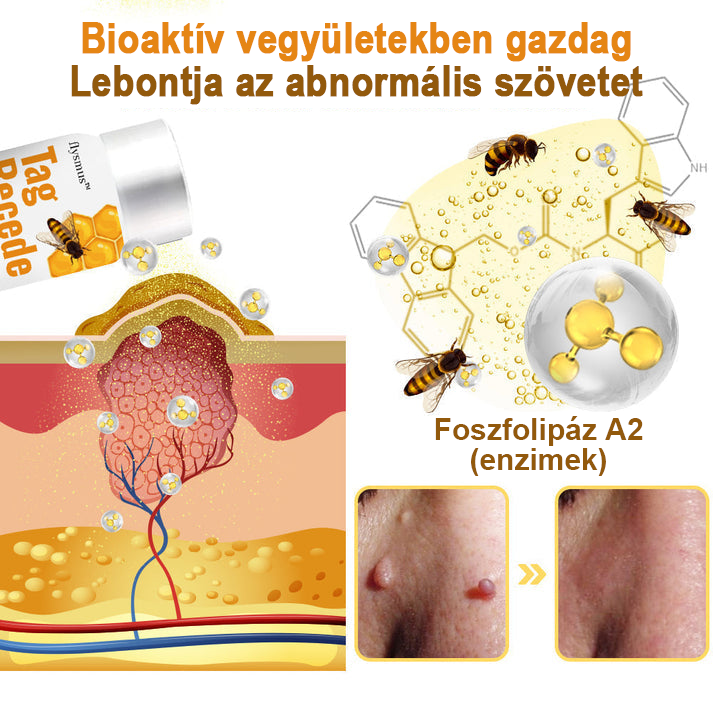 【💗utánvétel (COD)💗】Méhméreg szemölcs és övsömör eltávolító spray (👨⚕AAD Ajánlott) 🐝🐝🔥(🔥Last Day 80% Off)
