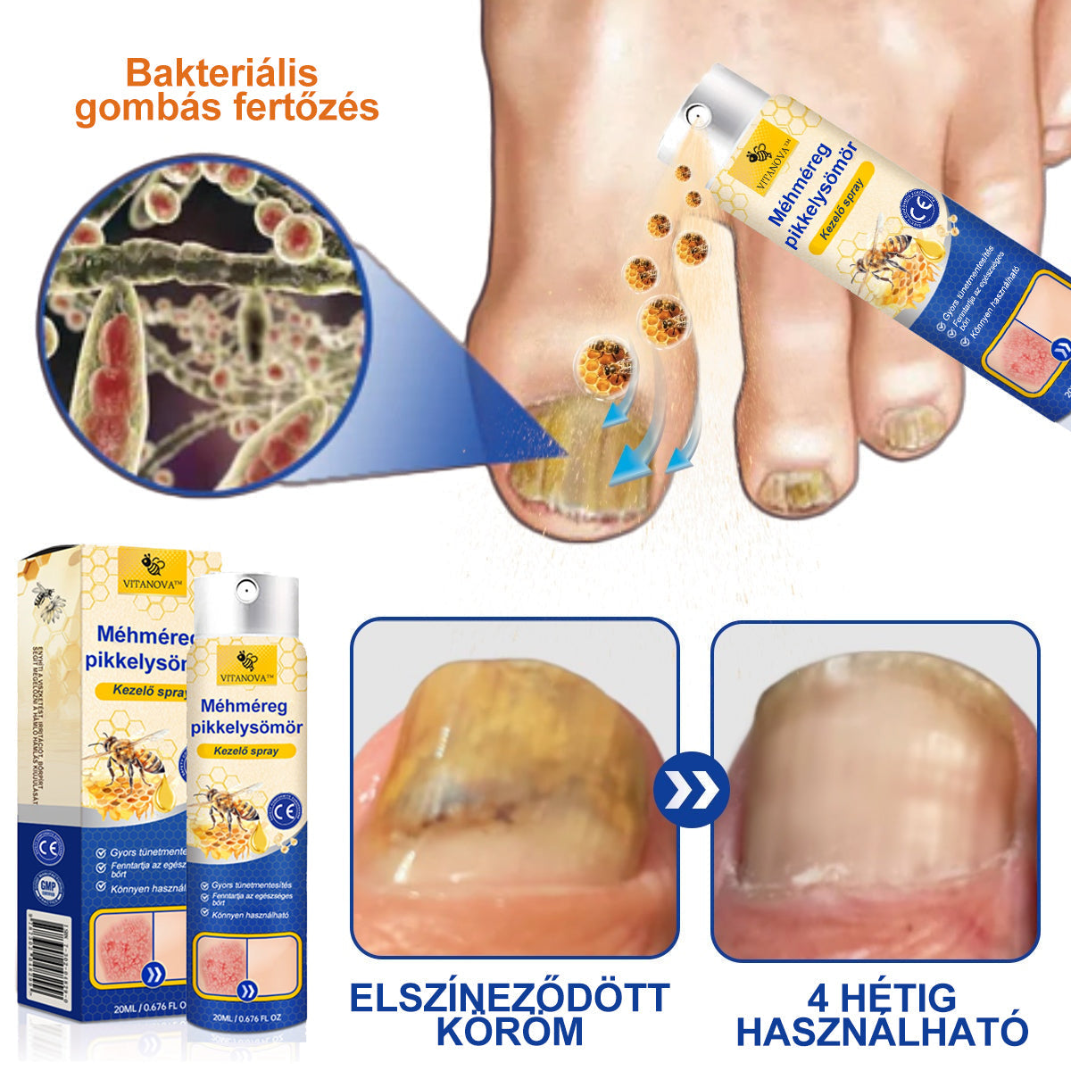 (đ„ 60% kedvezmĂ©ny az utolsĂł napi csomag vĂĄsĂĄrlĂĄsĂĄhoz đ„) VitaNovaâą PsoriaHeal psoriasis Spray prođ„GlobĂĄlis szĂĄllĂtĂĄs