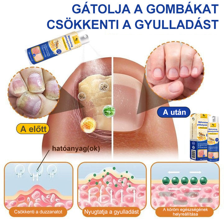 (đ„ 60% kedvezmĂ©ny az utolsĂł napi csomag vĂĄsĂĄrlĂĄsĂĄhoz đ„) VitaNovaâą PsoriaHeal psoriasis Spray prođ„GlobĂĄlis szĂĄllĂtĂĄs