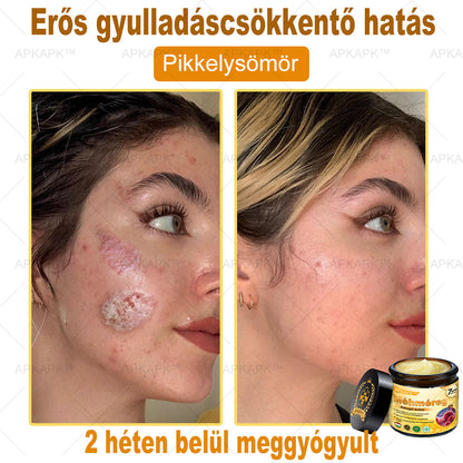𝐀𝐏𝐊𝐀𝐏𝐊™ 𝐌É𝐇𝐌É𝐑𝐄𝐆 Á𝐓𝐅𝐎𝐆Ó 𝐊𝐑É𝐌🥇🥇𝐀 𝐛ö𝐫𝐩𝐫𝐨𝐛𝐥é𝐦á𝐤 𝐤𝐞𝐳𝐞𝐥é𝐬𝐞 𝐦𝐚𝐠á𝐛𝐚𝐧 𝐟𝐨𝐠𝐥𝐚𝐥𝐣𝐚: é𝐥𝐞𝐭𝐤𝐨𝐫𝐢 𝐟𝐨𝐥𝐭𝐨𝐤, 𝐡𝐞𝐠𝐞𝐤, 𝐬𝐳𝐞𝐦ö𝐥𝐜𝐬ö𝐤, 𝐛ö𝐫𝐧ö𝐯𝐞𝐝é𝐤𝐞𝐤, 𝐭á𝐥𝐲𝐨𝐠𝐨𝐤, 𝐩𝐚𝐭𝐭𝐚𝐧á𝐬𝐨𝐤, 𝐞𝐤𝐜é𝐦𝐚, 𝐩𝐬𝐨𝐫𝐢𝐚𝐬𝐢𝐬, 𝐚𝐜𝐧𝐞 𝐢𝐧𝐯𝐞𝐫𝐬𝐚, 𝐫á𝐧𝐜𝐨𝐤, 𝐛ö𝐫ö𝐫𝐞𝐠𝐞𝐝é𝐬 é𝐬 𝐞𝐠𝐲é𝐛 𝐩𝐫𝐨𝐛𝐥é𝐦á𝐤🔥