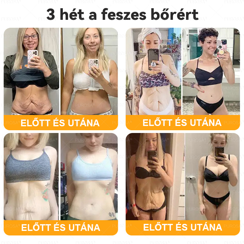 🐝🌿PUROSA® Méhméreg Bőrfelújító Krém 🔥 UTOLSÓ NAP – 80% KEDVEZMÉNY🔥