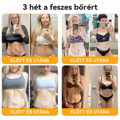🐝🌿PUROSA® Méhméreg Bőrfelújító Krém 🔥 UTOLSÓ NAP – 80% KEDVEZMÉNY🔥