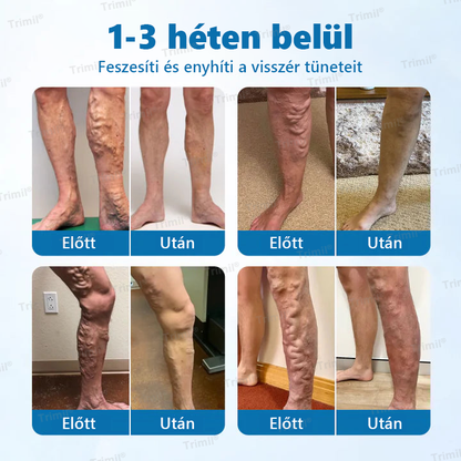 💚💚Trimil® VeinGuard Gyógynövényes Spray - ✅ Klinikailag bizonyított, hogy mindössze 7 nap alatt megszünteti a visszereket!💚💚
