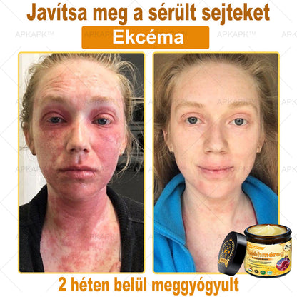 𝐀𝐏𝐊𝐀𝐏𝐊™ 𝐌É𝐇𝐌É𝐑𝐄𝐆 Á𝐓𝐅𝐎𝐆Ó 𝐊𝐑É𝐌🥇🥇𝐀 𝐛ö𝐫𝐩𝐫𝐨𝐛𝐥é𝐦á𝐤 𝐤𝐞𝐳𝐞𝐥é𝐬𝐞 𝐦𝐚𝐠á𝐛𝐚𝐧 𝐟𝐨𝐠𝐥𝐚𝐥𝐣𝐚: é𝐥𝐞𝐭𝐤𝐨𝐫𝐢 𝐟𝐨𝐥𝐭𝐨𝐤, 𝐡𝐞𝐠𝐞𝐤, 𝐬𝐳𝐞𝐦ö𝐥𝐜𝐬ö𝐤, 𝐛ö𝐫𝐧ö𝐯𝐞𝐝é𝐤𝐞𝐤, 𝐭á𝐥𝐲𝐨𝐠𝐨𝐤, 𝐩𝐚𝐭𝐭𝐚𝐧á𝐬𝐨𝐤, 𝐞𝐤𝐜é𝐦𝐚, 𝐩𝐬𝐨𝐫𝐢𝐚𝐬𝐢𝐬, 𝐚𝐜𝐧𝐞 𝐢𝐧𝐯𝐞𝐫𝐬𝐚, 𝐫á𝐧𝐜𝐨𝐤, 𝐛ö𝐫ö𝐫𝐞𝐠𝐞𝐝é𝐬 é𝐬 𝐞𝐠𝐲é𝐛 𝐩𝐫𝐨𝐛𝐥é𝐦á𝐤🔥