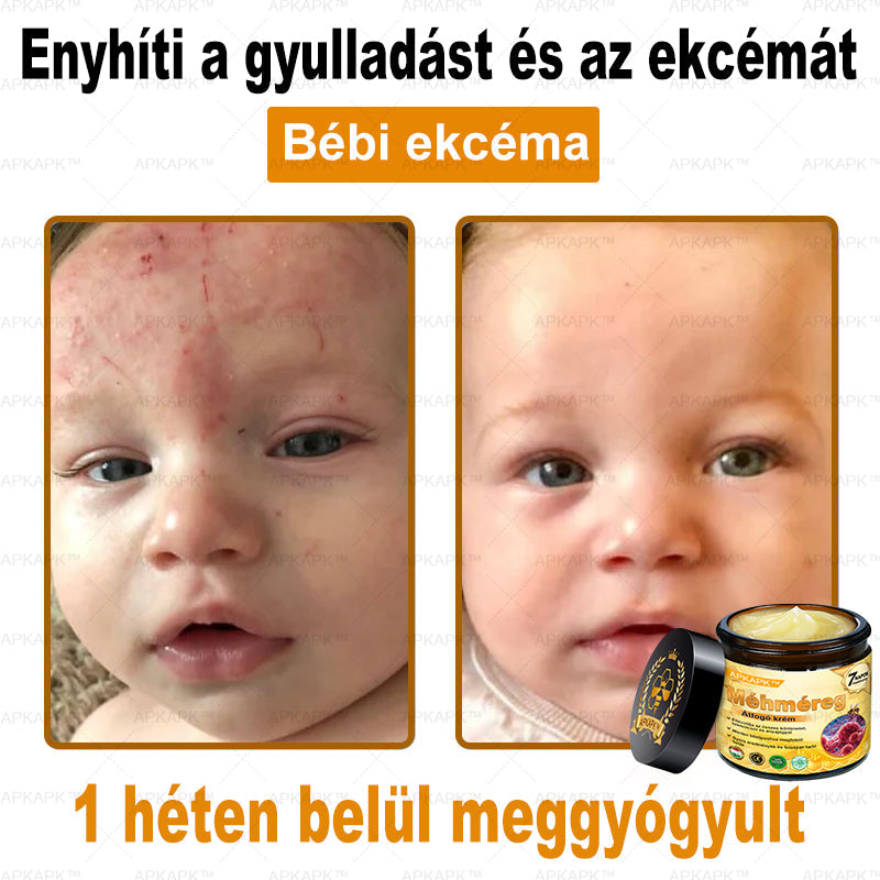 𝐀𝐏𝐊𝐀𝐏𝐊™ 𝐌É𝐇𝐌É𝐑𝐄𝐆 Á𝐓𝐅𝐎𝐆Ó 𝐊𝐑É𝐌🥇🥇𝐀 𝐛ö𝐫𝐩𝐫𝐨𝐛𝐥é𝐦á𝐤 𝐤𝐞𝐳𝐞𝐥é𝐬𝐞 𝐦𝐚𝐠á𝐛𝐚𝐧 𝐟𝐨𝐠𝐥𝐚𝐥𝐣𝐚: é𝐥𝐞𝐭𝐤𝐨𝐫𝐢 𝐟𝐨𝐥𝐭𝐨𝐤, 𝐡𝐞𝐠𝐞𝐤, 𝐬𝐳𝐞𝐦ö𝐥𝐜𝐬ö𝐤, 𝐛ö𝐫𝐧ö𝐯𝐞𝐝é𝐤𝐞𝐤, 𝐭á𝐥𝐲𝐨𝐠𝐨𝐤, 𝐩𝐚𝐭𝐭𝐚𝐧á𝐬𝐨𝐤, 𝐞𝐤𝐜é𝐦𝐚, 𝐩𝐬𝐨𝐫𝐢𝐚𝐬𝐢𝐬, 𝐚𝐜𝐧𝐞 𝐢𝐧𝐯𝐞𝐫𝐬𝐚, 𝐫á𝐧𝐜𝐨𝐤, 𝐛ö𝐫ö𝐫𝐞𝐠𝐞𝐝é𝐬 é𝐬 𝐞𝐠𝐲é𝐛 𝐩𝐫𝐨𝐛𝐥é𝐦á𝐤🔥