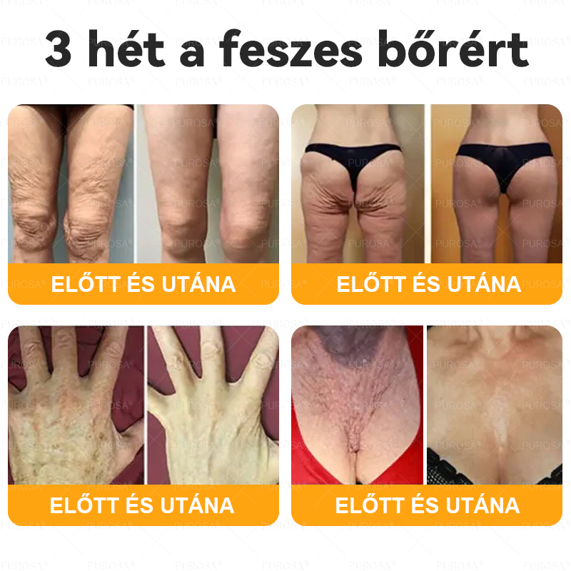 🐝🌿PUROSA® Méhméreg Bőrfelújító Krém 🔥 UTOLSÓ NAP – 80% KEDVEZMÉNY🔥