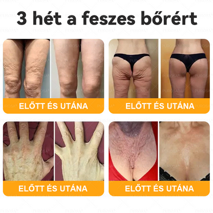 🐝🌿PUROSA® Méhméreg Bőrfelújító Krém 🔥 UTOLSÓ NAP – 80% KEDVEZMÉNY🔥