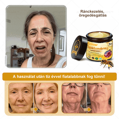 𝐀𝐏𝐊𝐀𝐏𝐊™ 𝐌É𝐇𝐌É𝐑𝐄𝐆 Á𝐓𝐅𝐎𝐆Ó 𝐊𝐑É𝐌🥇🥇𝐀 𝐛ö𝐫𝐩𝐫𝐨𝐛𝐥é𝐦á𝐤 𝐤𝐞𝐳𝐞𝐥é𝐬𝐞 𝐦𝐚𝐠á𝐛𝐚𝐧 𝐟𝐨𝐠𝐥𝐚𝐥𝐣𝐚: é𝐥𝐞𝐭𝐤𝐨𝐫𝐢 𝐟𝐨𝐥𝐭𝐨𝐤, 𝐡𝐞𝐠𝐞𝐤, 𝐬𝐳𝐞𝐦ö𝐥𝐜𝐬ö𝐤, 𝐛ö𝐫𝐧ö𝐯𝐞𝐝é𝐤𝐞𝐤, 𝐭á𝐥𝐲𝐨𝐠𝐨𝐤, 𝐩𝐚𝐭𝐭𝐚𝐧á𝐬𝐨𝐤, 𝐞𝐤𝐜é𝐦𝐚, 𝐩𝐬𝐨𝐫𝐢𝐚𝐬𝐢𝐬, 𝐚𝐜𝐧𝐞 𝐢𝐧𝐯𝐞𝐫𝐬𝐚, 𝐫á𝐧𝐜𝐨𝐤, 𝐛ö𝐫ö𝐫𝐞𝐠𝐞𝐝é𝐬 é𝐬 𝐞𝐠𝐲é𝐛 𝐩𝐫𝐨𝐛𝐥é𝐦á𝐤🔥