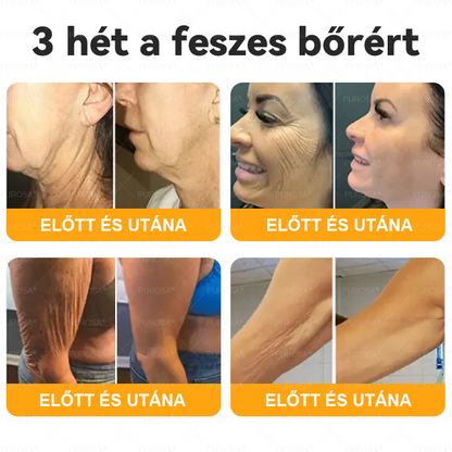 🐝🌿PUROSA® Méhméreg Bőrfelújító Krém 🔥 UTOLSÓ NAP – 80% KEDVEZMÉNY🔥