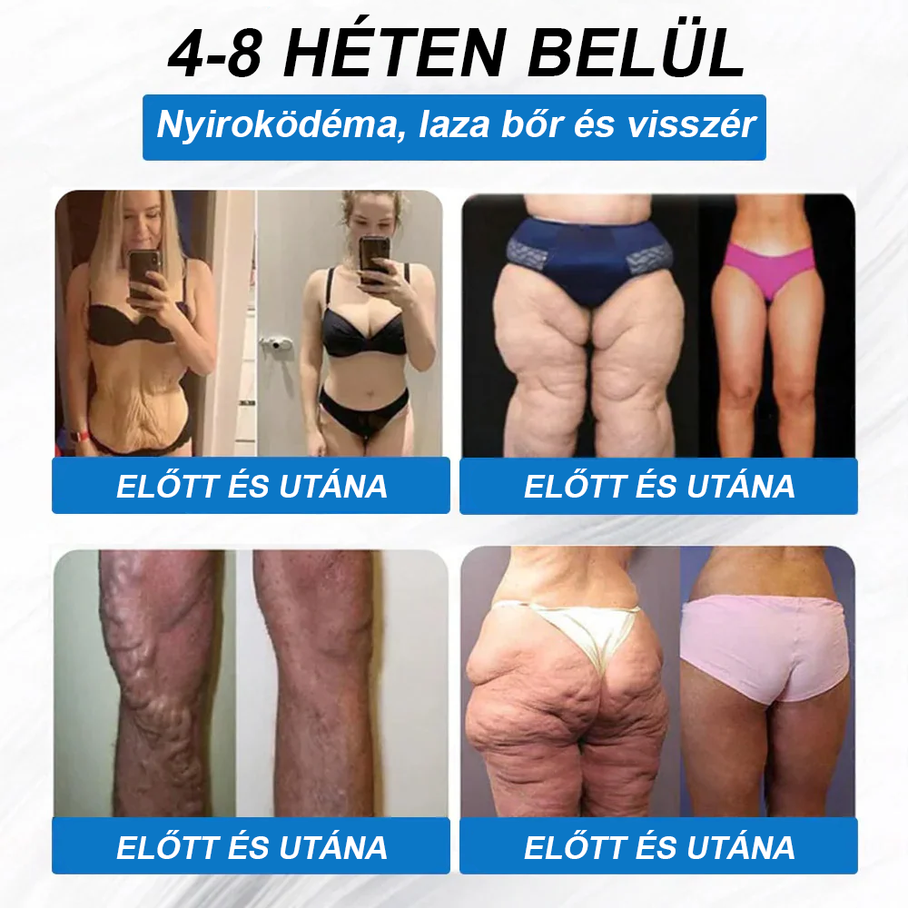 [Lásd az eredményeket 7 nap múlva]🌲WarmFamily® SMGT-GLP-1 nano mikrotűs tapasz (Fájdalommentes, hosszan tartó, kezeli a cukorbetegséget, az elhízást és a szív- és érrendszeri betegségeket)