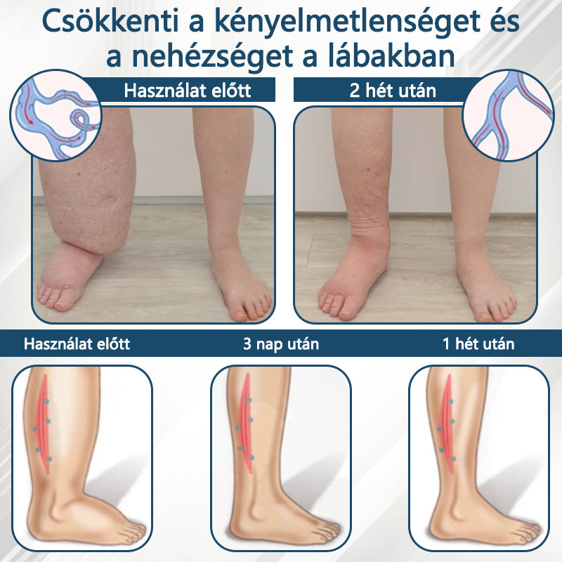 Cvreoz® Fekete kömény Ödéma méregtelenítő gyógynövénykrém💙