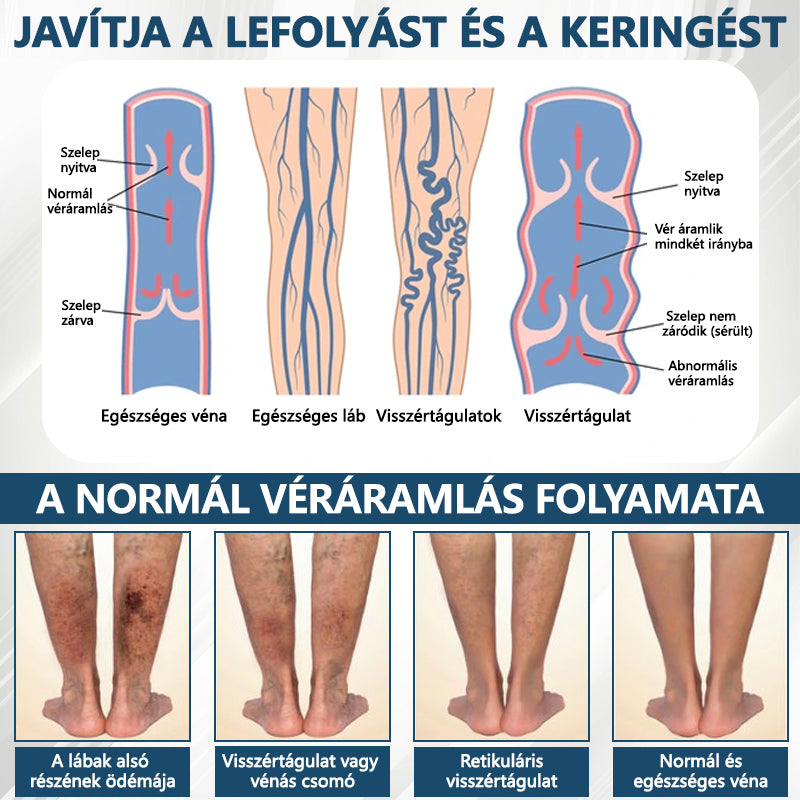 Cvreoz® Fekete kömény Ödéma méregtelenítő gyógynövénykrém💙