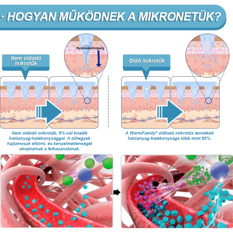 [Lásd az eredményeket 7 nap múlva]🌲WarmFamily® SMGT-GLP-1 nano mikrotűs tapasz (Fájdalommentes, hosszan tartó, kezeli a cukorbetegséget, az elhízást és a szív- és érrendszeri betegségeket)