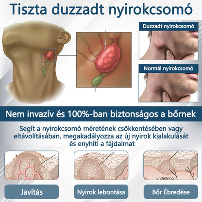 Cvreoz® Fekete kömény Ödéma méregtelenítő gyógynövénykrém💙